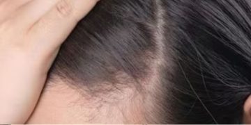 ഉള്ള് കുറഞ്ഞ തലമുടിയാണോ? പരീക്ഷിക്കാം ഈ കിടിലന്‍ ഹെയര്‍ പാക്കുകള്‍…