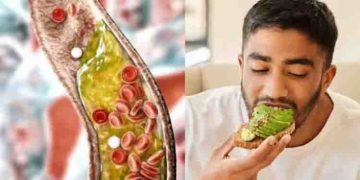 ചീത്ത കൊളസ്ട്രോള്‍ കുറയ്ക്കാന്‍ ഒഴിവാക്കേണ്ടതും കഴിക്കേണ്ടതുമായ ഭക്ഷണങ്ങള്‍…