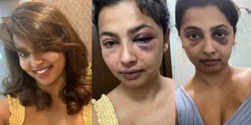 ക്രൂരമായി മർദ്ദിച്ചു, ഫോൺ എറിഞ്ഞുടച്ചു, വാട്സാപ്പ് ഒളിച്ച് നിരീക്ഷിച്ചു; മുൻ കാമുകനെതിരെ നടി