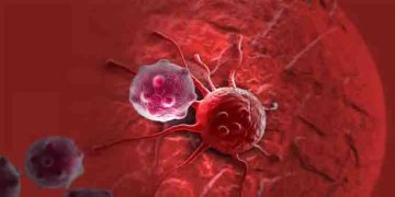 കാൻസർ സാധ്യത കുറയ്ക്കുന്നതിന് ജീവിത ശെെലിയിൽ ശ്രദ്ധിക്കേണ്ടത്…