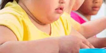 കുട്ടികളിലെ അമിതവണ്ണം; മാതാപിതാക്കള്‍ നിര്‍ബന്ധമായും ഇക്കാര്യങ്ങള്‍ ശ്രദ്ധിക്കുക…