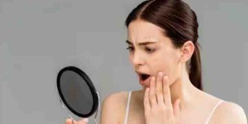 എണ്ണമയമുള്ള ചർമ്മത്തിന് ഡയറ്റില്‍ നിന്നും ഒഴിവാക്കേണ്ട ഏഴ് ഭക്ഷണങ്ങൾ…