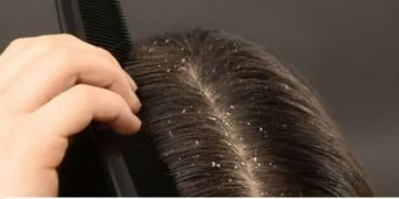 മുടികൊഴിച്ചിലും താരനും അകറ്റാൻ രണ്ട് ചേരുവകൾ കൊണ്ടൊരു ഹെയർ പാക്ക്