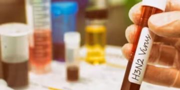 എച്ച്3എൻ2 വൈറസ് വൃക്കകളെ ബാധിക്കുമോ?