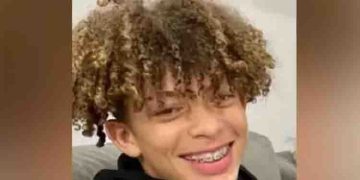 ടിക്ടോക്കിൽ ചലഞ്ച്, സ്ഫോടനം, 16 -കാരന് 80% പൊള്ളൽ, മോനെ കണ്ടാൽ തിരിച്ചറിയാനാകുന്നില്ലെന്ന് അമ്മ