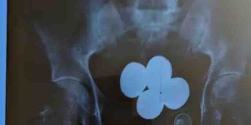 സ്വർണക്കടത്ത്: വിമാനത്താവളത്തിൽ കസ്റ്റംസിനെ വെട്ടിച്ചു; പുറത്ത് കടന്നപ്പോൾ പൊലീസ് ‘പൊക്കി’