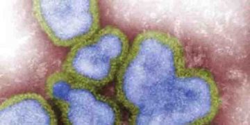 എന്താണ് H3N8 വൈറസ്? തിരിച്ചറിയാം ഈ ലക്ഷണങ്ങളെ…