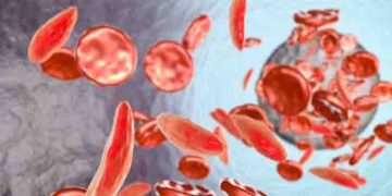 വിളർച്ച അകറ്റാൻ കഴിക്കാം അഞ്ച് ഭക്ഷണങ്ങൾ