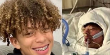 ടിക് ടോക് ചാലഞ്ച്: പെയിന്റ് ക്യാൻ പൊട്ടിത്തെറിച്ച് 16കാരന് 80% പൊള്ളൽ