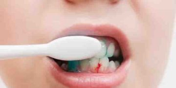 ബ്രഷ് ചെയ്യുമ്പോള്‍ അധികം ശക്തി കൊടുക്കുന്നത് നല്ലതല്ല; കാരണം അറിയാം…