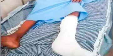 മദ്യ​ല​ഹ​രി​യി​ൽ കു​ട്ടി​ക​ൾ​ക്ക് നേ​രെ അ​യ​ൽ​വാ​സി​യു​ടെ പരാക്രമം ; 14കാരന്റെ കാൽവിരൽ അറ്റുതൂങ്ങി