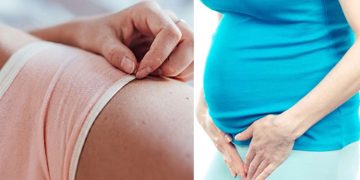 സ്വകാര്യഭാഗത്തെ കറുപ്പ് ഓർത്ത് ഇനി വിഷമിക്കേണ്ട; മാറ്റാൻ എളുപ്പവഴികൾ