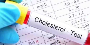എന്താണ് ഉയർന്ന കൊളസ്ട്രോൾ? ഭക്ഷണത്തിൽ ശ്രദ്ധിക്കേണ്ടത് എന്തൊക്കെ?