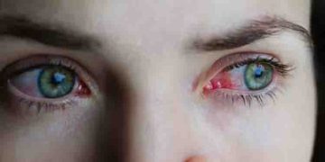 മഴക്കാലത്ത് ചെങ്കണ്ണിനെ സൂക്ഷിക്കണം; ശ്രദ്ധിക്കേണ്ട കാര്യങ്ങള്‍…