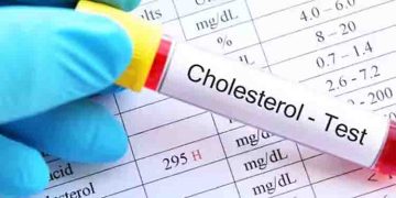നല്ല കൊളസ്ട്രോൾ കൂട്ടാൻ സഹായിക്കുന്ന ആറ് ഭക്ഷണങ്ങൾ