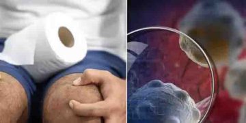 മലദ്വാരത്തിലെ ക്യാൻസര്‍; ശ്രദ്ധിക്കാതെ പോകുന്ന ലക്ഷണങ്ങള്‍…