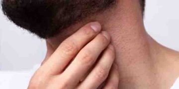 എന്താണ് ‘ഹെഡ് ആന്‍റ് നെക്ക് ക്യാൻസര്‍’?; അപകടകാരിയായ രോഗത്തിന്‍റെ ലക്ഷണങ്ങള്‍ അറിയൂ