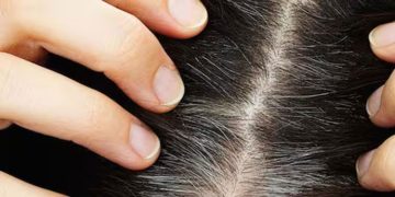 ഈ ഭക്ഷണങ്ങള്‍ കഴിച്ചോളൂ, അകാലനര തടയാം