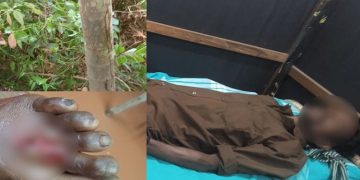 കരടി ആക്രമണത്തിൽ ഒരാൾക്ക് ഗുരുതര പരുക്ക്