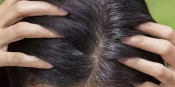 അകാലനര അകറ്റാം ; വീട്ടിൽ തന്നെ പരീക്ഷിക്കാം ഈ പൊടിക്കൈകൾ