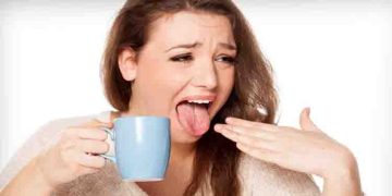 ചൂടുള്ള ഭക്ഷണ-പാനീയങ്ങള്‍ കഴിച്ച് നാവ് പൊള്ളിയാല്‍ എന്ത് ചെയ്യണം?