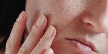 വരണ്ട ചര്‍മ്മമാണോ? ശ്രദ്ധിക്കേണ്ട ഏഴ് കാര്യങ്ങള്‍…