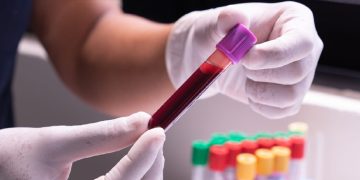 ലഹരി ഉപയോഗം : രക്ത സാംപിളെടുക്കാൻ സമ്മതിച്ചില്ലെങ്കിൽ ജയില്‍ശിക്ഷയും വൻതുക പിഴയും