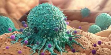 കഴിഞ്ഞ 30 വര്‍ഷത്തിനുള്ളില്‍ 50 വയസ്സിന് താഴെയുള്ളവരിൽ കാൻസർ 79 % വർദ്ധിച്ചതായി പഠനം