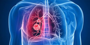 ശ്വാസകോശ രോഗങ്ങളകറ്റാൻ ജീവിത രീതികളില്‍ നിങ്ങള്‍ കരുതേണ്ട 5 കാര്യങ്ങള്‍