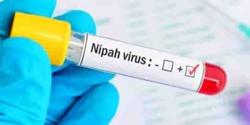 നിപ സംശയം; കുട്ടികൾ ​ഗുരുതരാവസ്ഥയിൽ, യുവാവിന്റെ നില തൃപ്തികരം