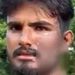 ഭാര്യ ചൂടുവെള്ളത്തിൽ മുളക് കലക്കി മുഖത്തൊഴിച്ചു; ഭർത്താവ് ആശുപത്രിയിൽ