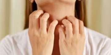 സ്ത്രീകളില്‍ മുഖത്ത് അമിത രോമവളര്‍ച്ച; അറിഞ്ഞിരിക്കേണ്ട ലക്ഷണങ്ങള്‍…