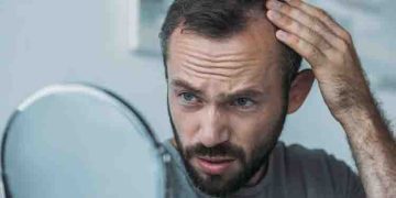 പുരുഷന്മാരിൽ കഷണ്ടി ഉണ്ടാകുന്നതിന് പിന്നിലെ നാല് കാരണങ്ങൾ