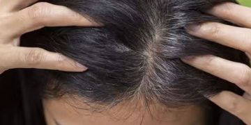 അകാലനരയാണോ നിങ്ങളെ അലട്ടുന്നത്? ഇവയാകാം കാരണം…