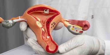 ​സെർവിക്കൽ കാൻസർ ; ശരീരം കാണിക്കുന്ന അഞ്ച് ലക്ഷണങ്ങൾ