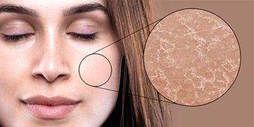 വരണ്ട ചര്‍മ്മം മാറാന്‍ വീട്ടില്‍ പരീക്ഷിക്കാം ഇക്കാര്യങ്ങള്‍