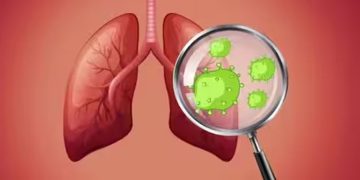 ഈ ലക്ഷണങ്ങൾ അവ​ഗണിക്കരുത്, ലങ് കാൻസറിന്റേതാകാം