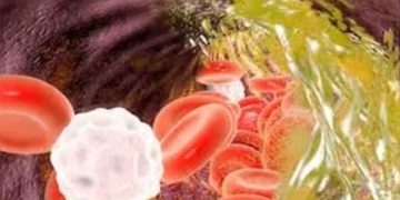 മരുന്നുകളില്ലാതെ കൊളസ്ട്രോൾ കുറയ്ക്കാം ; ഈ മൂന്ന് ഭ​ക്ഷണങ്ങൾ ഡയറ്റിൽ ഉൾപ്പെടുത്തൂ