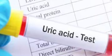 ശരീരത്തില്‍ യൂറിക് ആസിഡ് കൂടുന്നുണ്ടോ? അറിയാം ഈ ലക്ഷണങ്ങളും കഴിക്കേണ്ട ഭക്ഷണങ്ങളും…