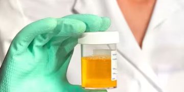 മൂത്രത്തിന്‍റെ നിറത്തിലുള്ള ഈ വ്യത്യാസങ്ങള്‍ പ്രത്യേകം ശ്രദ്ധിക്കുക; ഇത് സൂചിപ്പിക്കുന്ന രോഗങ്ങള്‍…