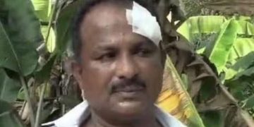 വിവാഹച്ചടങ്ങിനിടെ അക്രമം ; വധുവിന്റെ പിതാവിനും എട്ടു വയസുകാരിക്കും ഉള്‍പ്പെടെ നിരവധി പേര്‍ക്ക് പരിക്ക്