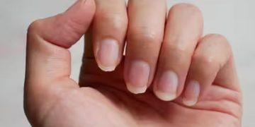 നഖങ്ങളും പല്ലുകളും പൊട്ടുന്നു, കൂടെ ശരീരവേദനയും പതിവെങ്കില്‍ പരിശോധിക്കേണ്ടത്….