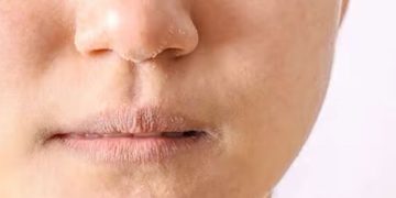 മുഖം ഡ്രൈ ആയി ഇത്രയും പ്രശ്നാകാറുണ്ടോ? ; പരിഹാരമായി ചെയ്യാവുന്നത്…