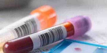 ഷെയ്‍നില്‍ നിന്നും വസ്ത്രം ഓര്‍ഡർ ചെയ്തു; കിട്ടിയത് ഒരു കുപ്പി രക്തം, പിന്നെ കുറച്ച് ബീന്‍സുമെന്ന് യുവതി