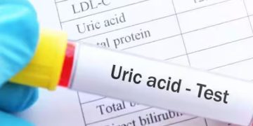 യൂറിക് ആസിഡിൻ്റെ അളവ് കുറയ്ക്കാൻ ശീലമാക്കാം ആറ് ഭക്ഷണങ്ങൾ