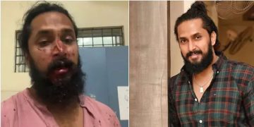 കന്നഡ നടൻ ചേതൻ ചന്ദ്രക്ക് നേരെ ആൾക്കൂട്ട ആക്രമണം