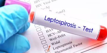 തലസ്ഥാനത്ത് എലിപ്പനി ബാധിച്ച് ഒരാൾ മരിച്ചു