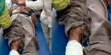 ഹാ​സ​നി​ൽ കാ​ട്ടാ​ന​യു​ടെ ആ​ക്ര​മ​ണ​ത്തി​ൽ തൊ​ഴി​ലാ​ളി​ക്ക് പ​രി​ക്ക്