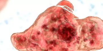 ചികിത്സയിലുള്ള വിദ്യാർഥിക്ക് അമീബിക് മസ്തിഷ്‍ക ജ്വരം സ്ഥിരീകരിച്ചു