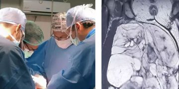 10 കിലോ ഭാരമുള്ള മുഴ കാരണം നടക്കാന്‍ കഴിയാതെ വന്ന 61കാരിക്ക് ആശ്വാസമേകി തൃശൂര്‍ മെഡിക്കല്‍ കോളജ്